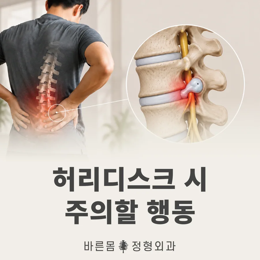 허리 디스크관리, 통증이 반복될 때 먼저 줄여야 할 생활 습관들 1